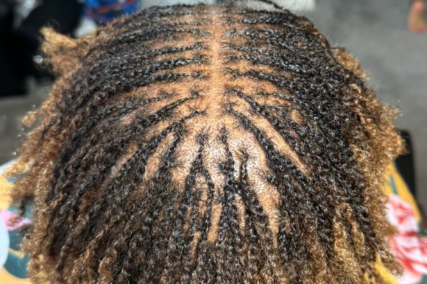 Microlocs maintenance